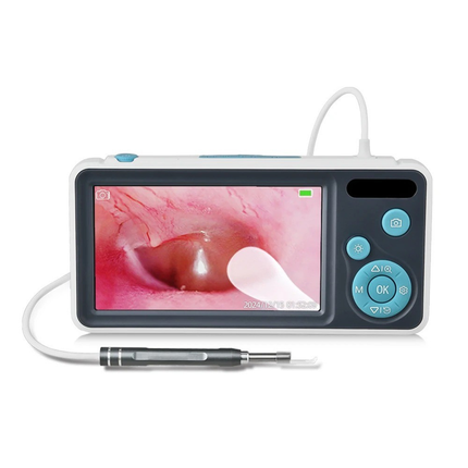 HD Ear Inspection Camera with 4.3 inch Screen & Adjustable LED Lighting