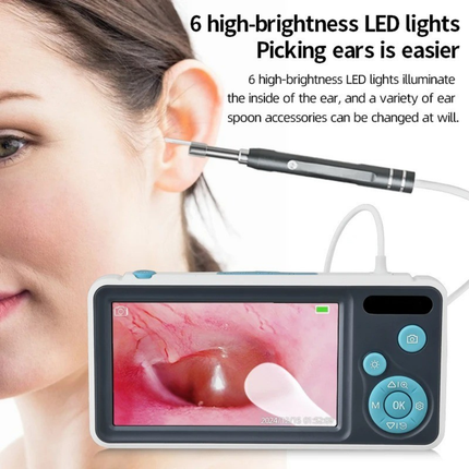 HD Ear Inspection Camera with 4.3 inch Screen & Adjustable LED Lighting