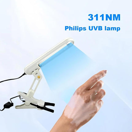 Portable 311nm UVB Photorelaxation Lamp with Philips Bulb for Targeted Skin Care & Pigmentation Support
