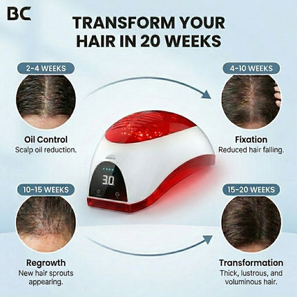 LED Hair Growth Helmet with 176 Lasers – Red Light Relaxation for Thinning Hair and Hair Loss