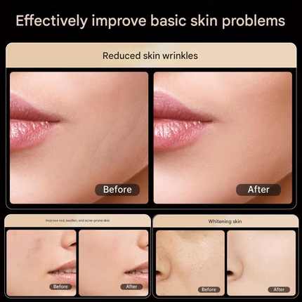 Portable LED Facial Mask with Remote Control & Base Stand 2.5W Rechargeable 3H Use
