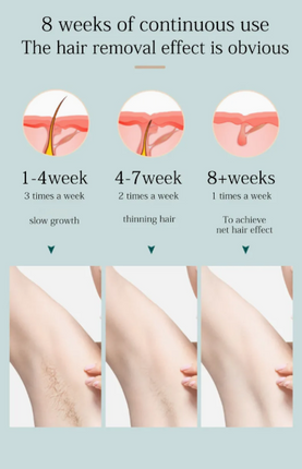 Portable IPL Hair Removal Device for Home Use with 9 Adjustable Energy Levels