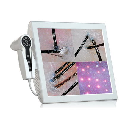 15 Inch HD Hair Scalp Analyzer with 50x 200x Magnification Lenses