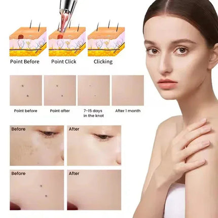 Cordless Light-Based Skin Care Device 440–460nm Rechargeable Handheld for Spot & Blemish Appearance Care