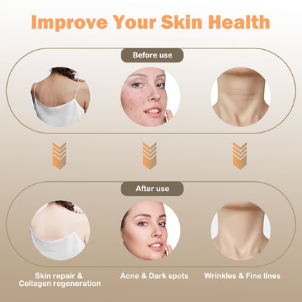 LED Facial Beauty Mask with 4 Light Modes Rechargeable Silicone Face and Neck Care Device