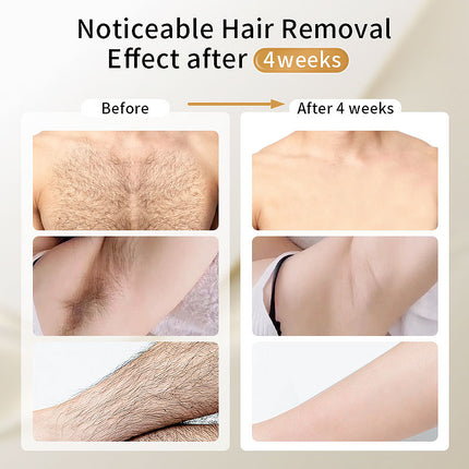 Portable IPL Hair Removal Device with Ice Cooling and Adjustable Intensity for Home Use
