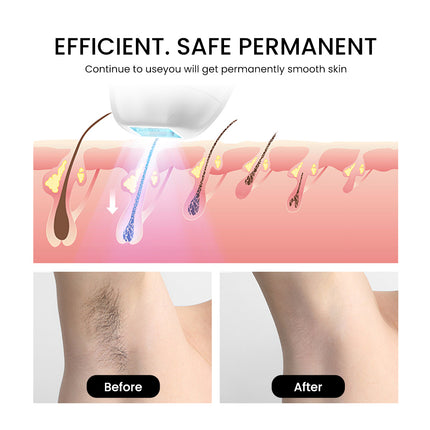 Compact IPL Personal Care Device for Body and Face, Adjustable Light Pulse System
