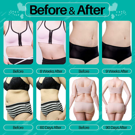 6-in-1 Ultrasound Cavitation RF Body Sculpting and Facial Beauty Machine