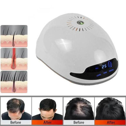 Rechargeable Red Light Hair Growth Helmet 126 LED Laser Relaxation Cap for Thinning Hair