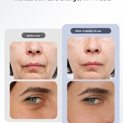 Rechargeable Facial Lifting Device Microcurrent LED Light Relaxation Cooling Portable