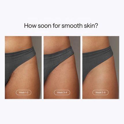 12J IPL Hair Removal System with Quartz Lamp & Adjustable Intensity