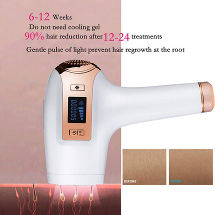 Portable IPL Laser Hair Removal Handset with Ice Cooling for Home Use