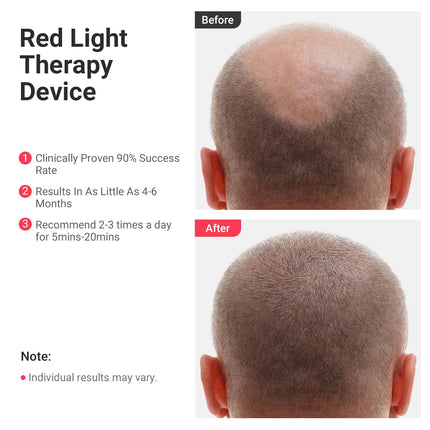 Portable Dual Wavelength Red Light Relaxation Device 650nm 808nm Handheld White