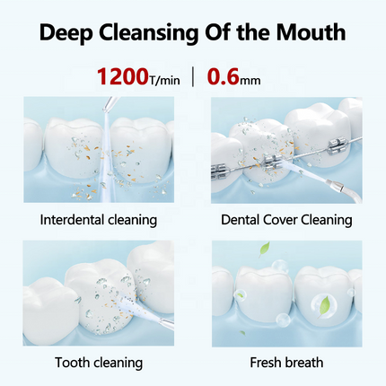Portable Rechargeable Water Flosser with 160ml Detachable Tank & 4 Nozzles