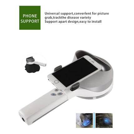 Wellness UV Wood Lamp Magnifier for Skin Diagnosis and Vitiligo Detection