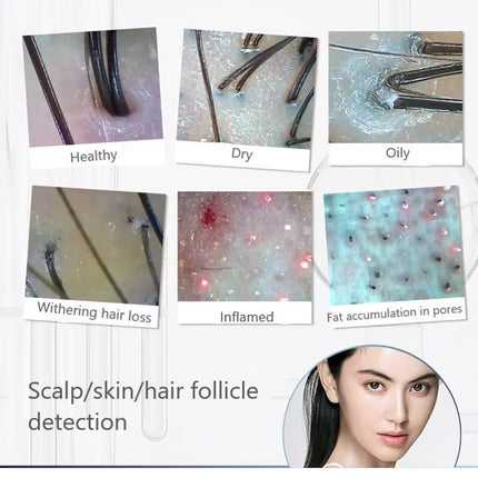 Portable Hair Scalp Analysis Camera Wireless 1080p 200x Magnification Rechargeable