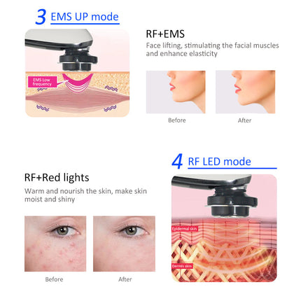 RF Facial Lifting Wand for At-Home Skin Firming & Anti-Aging Care
